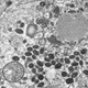 Illustration for article titled In the 1970s, A Weaponized Version Of Smallpox Got Out Into The Wild